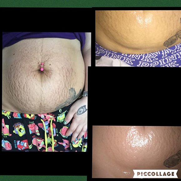 Bio Oil - Picture 10 of 10